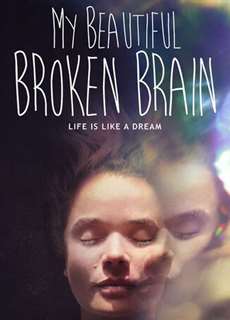 Khối óc xinh đẹp tội nghiệp của tôi - My Beautiful Broken Brain - (2016) - PhimMoi2024 - Website xem phim miễn phí tốt nhất